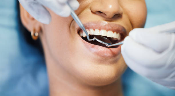 Best Emergency Root Canal Treatment in Lakemoor, IL