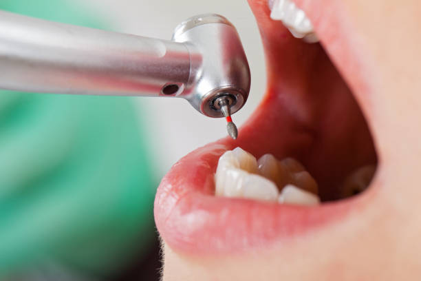 Best Emergency Dentist for Special Needs Patients in Lakemoor, IL